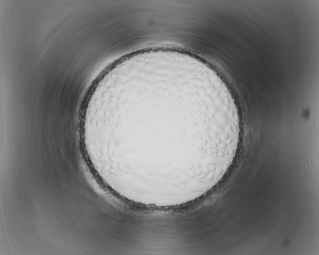 X0000116131038201001041007