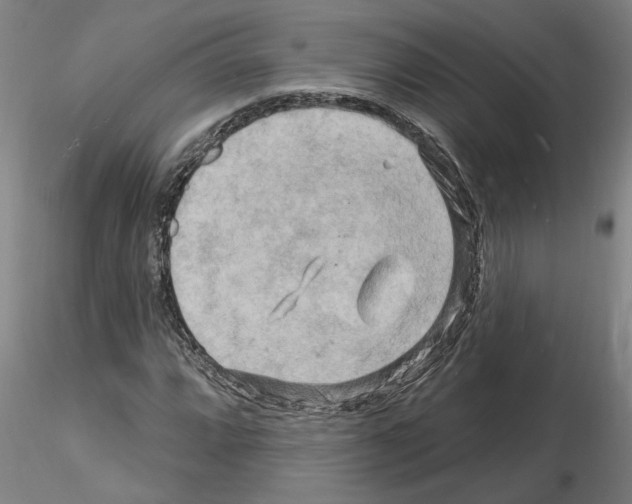 X0000116131064201001041007