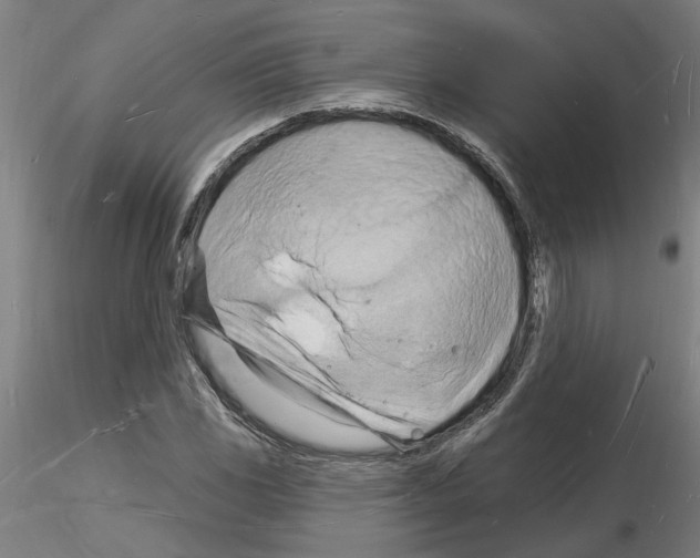X0000116131117201001041006
