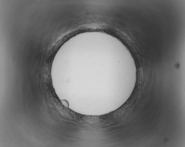 X0000116131158201001041005