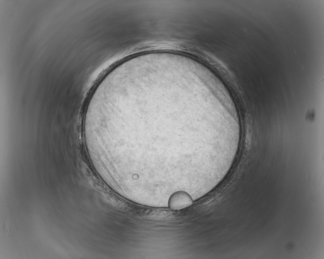 X0000116131174201001041005