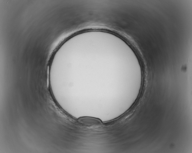 X0000116131175201001041005