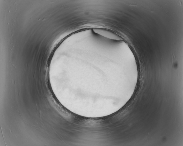 X0000116131179201001041005