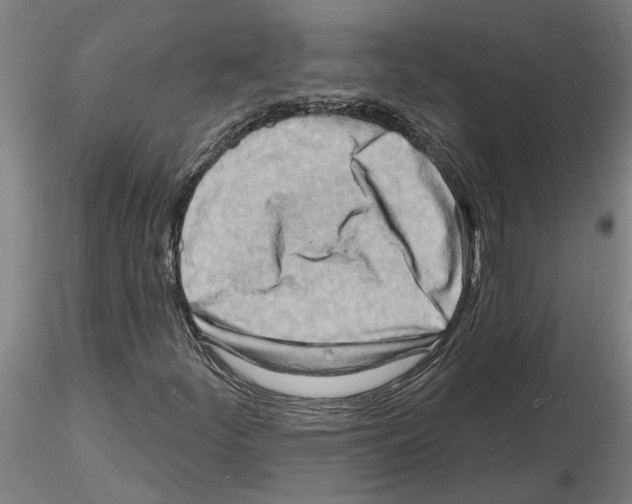 X0000116131252201001041004