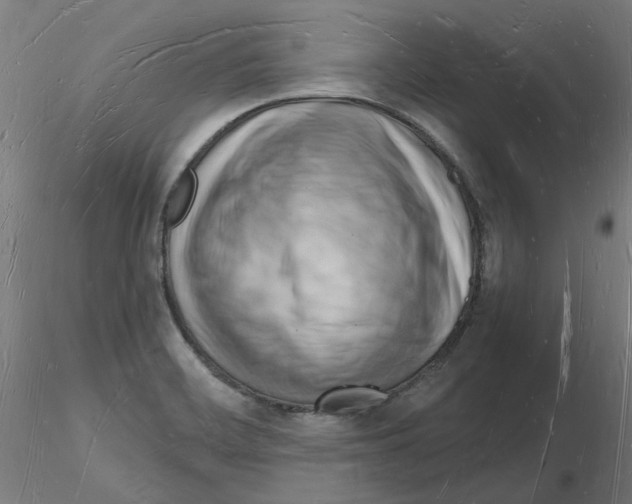 X0000116131468201001041001
