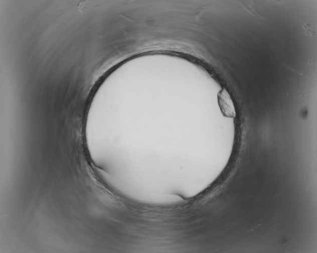 X0000116131505201001041000