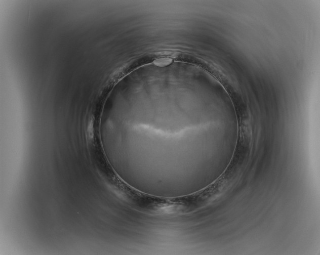 X0000116140504200911301523