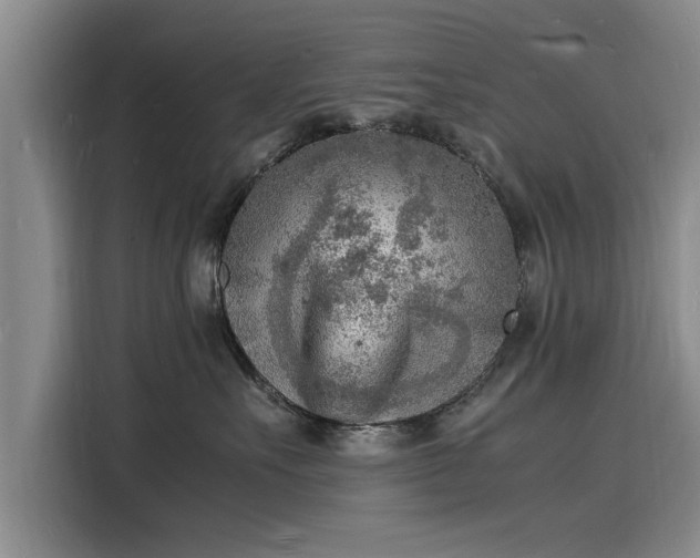X0000116140527200911301523