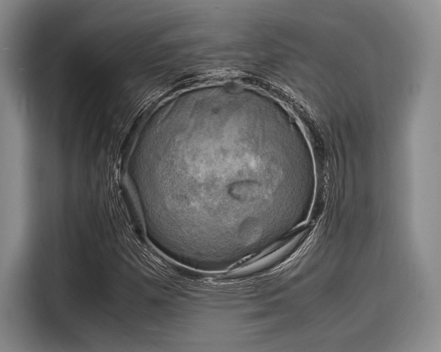 X0000116141257200911301514