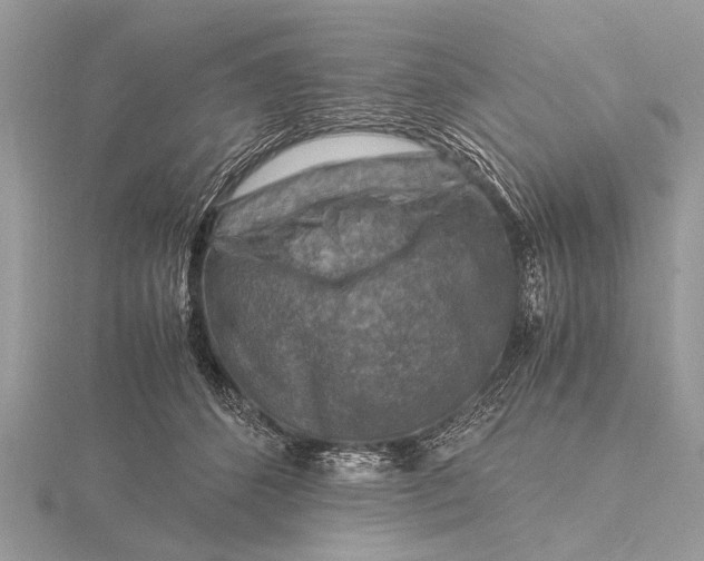 X0000116140512200912071245