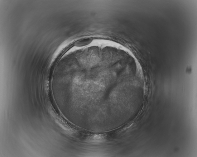 X0000116140056200912141143