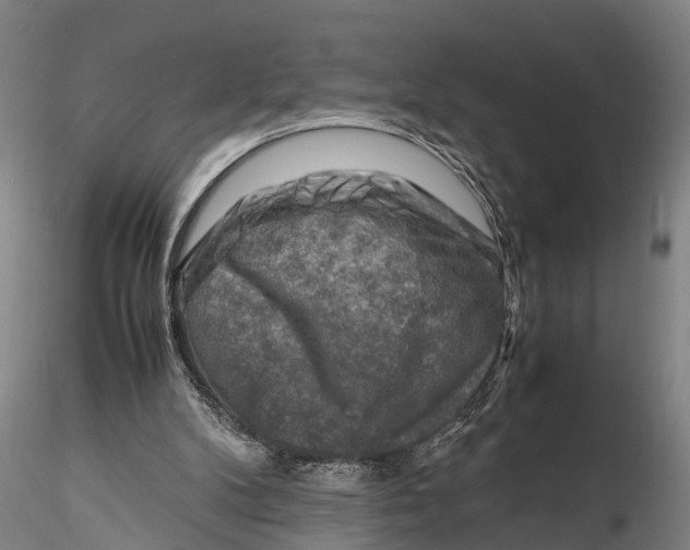 X0000116140104200912141142