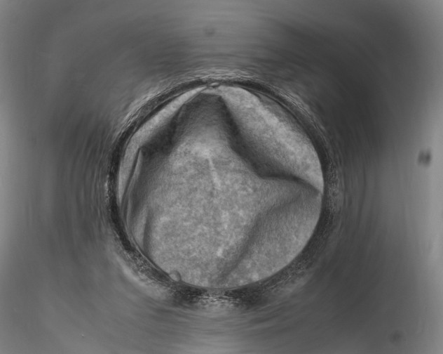 X0000116140207200912141141