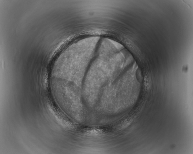 X0000116140304200912141139