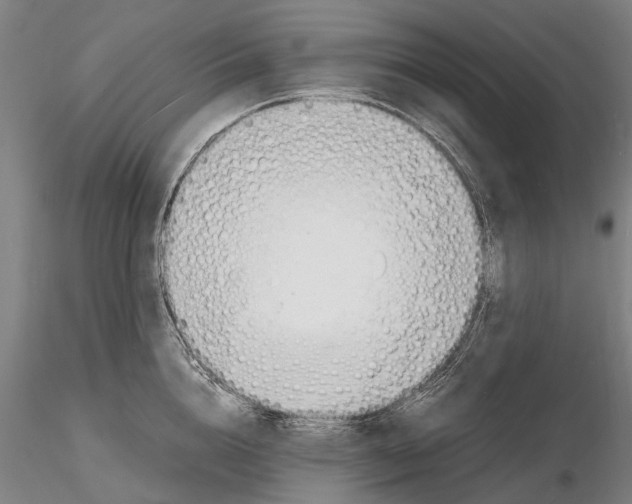 X0000116140856200912141131