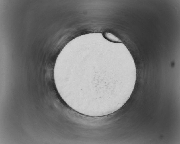 X0000116140035201001041042