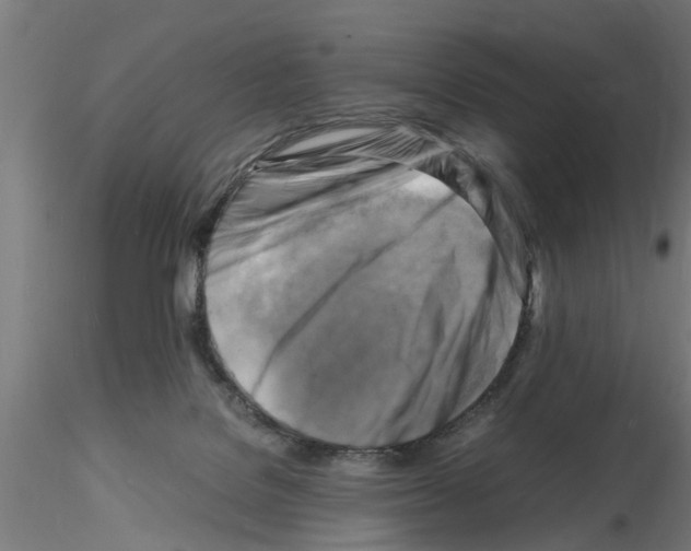 X0000116140076201001041041