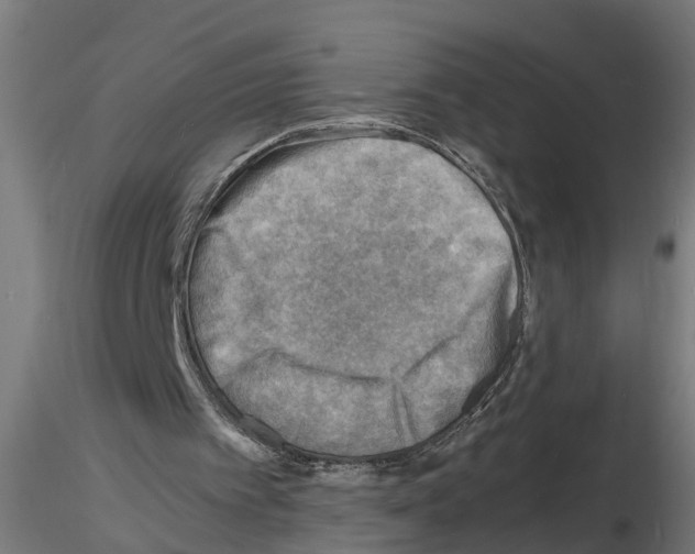 X0000116140097201001041041