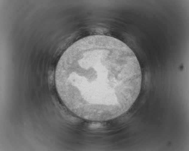 X0000116140177201001041040