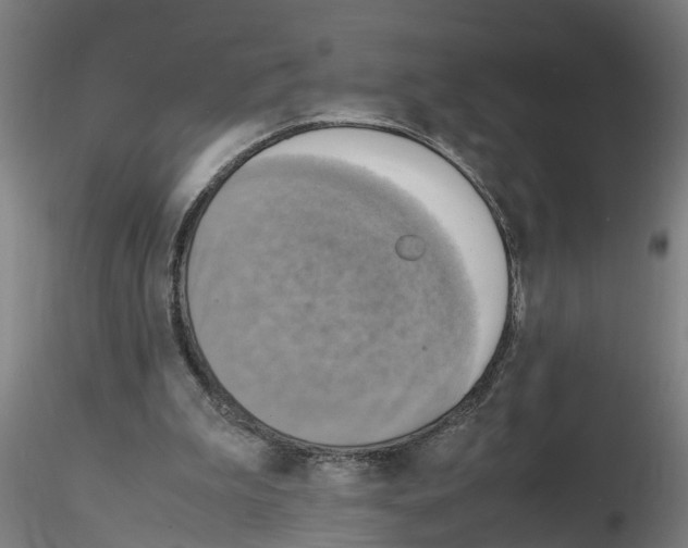 X0000116140199201001041039