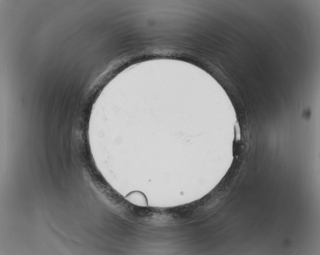 X0000116140256201001041038