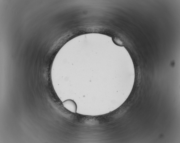 X0000116140258201001041038