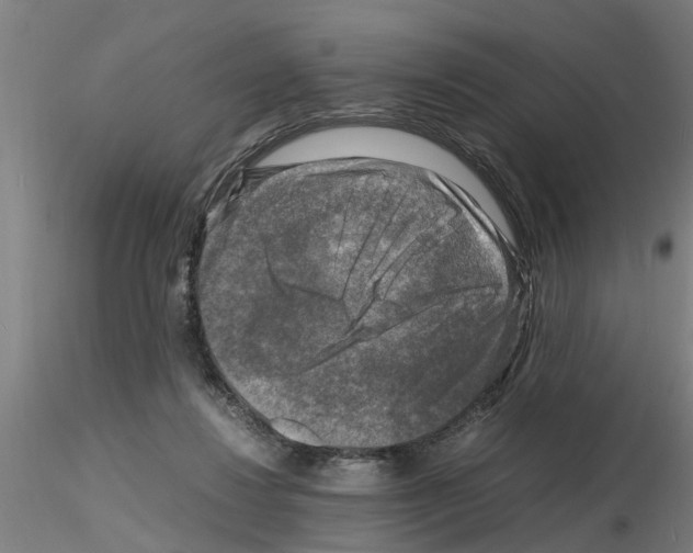 X0000116140260201001041038