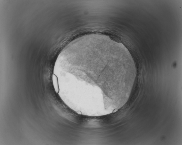 X0000116140268201001041038