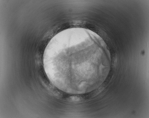 X0000116140272201001041038