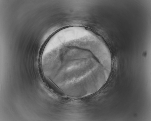 X0000116140292201001041038