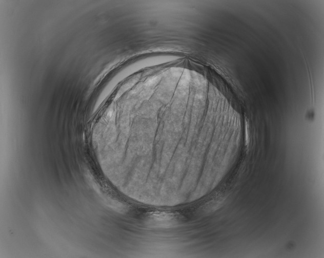 X0000116140300201001041038