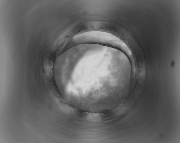 X0000116140332201001041037