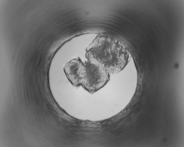 X0000116140337201001041037