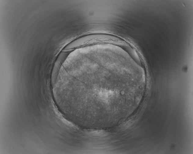 X0000116140385201001041037