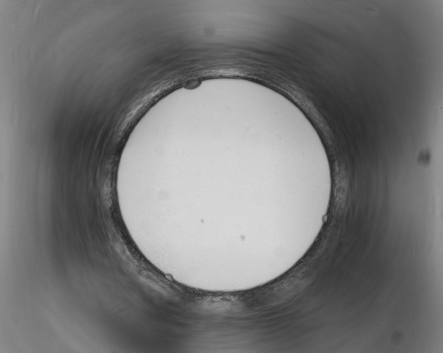 X0000116140386201001041037