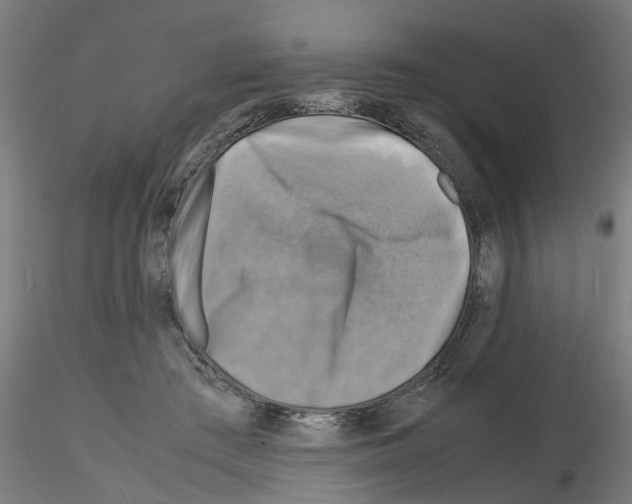 X0000116140409201001041036