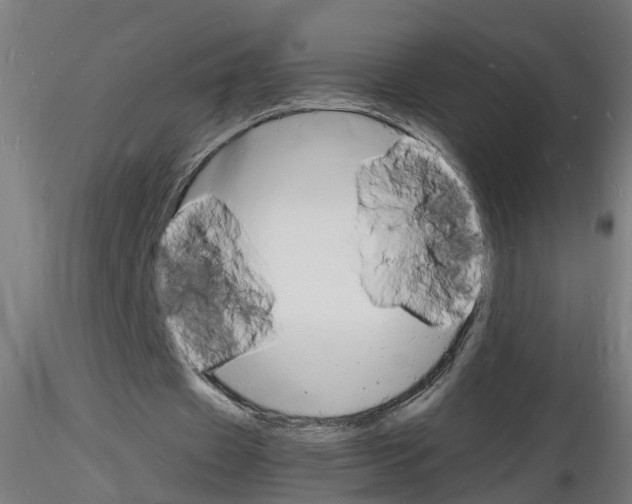 X0000116140433201001041035