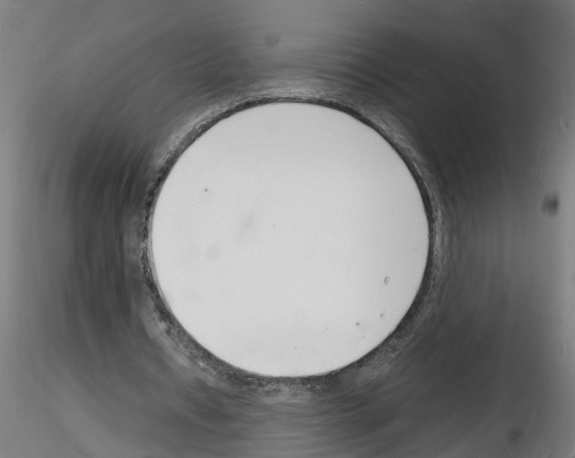 X0000116140434201001041035