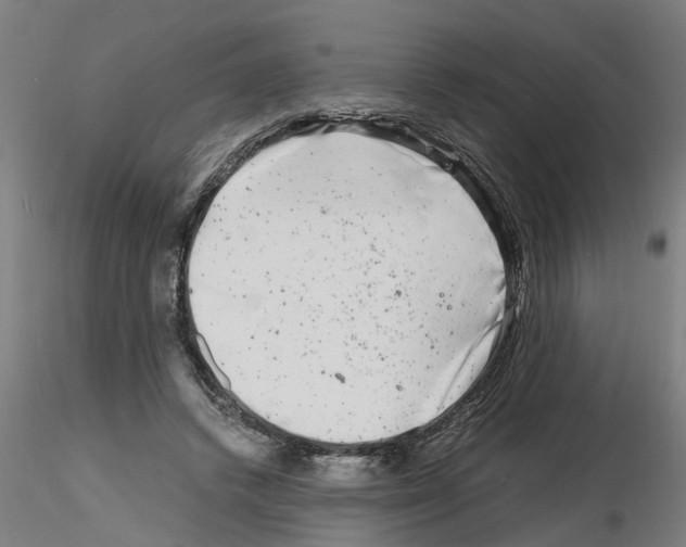 X0000116140448201001041036