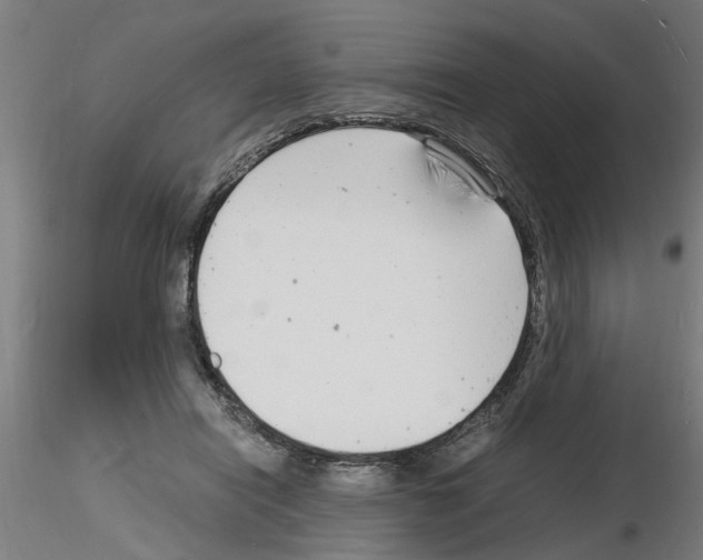 X0000116140454201001041036