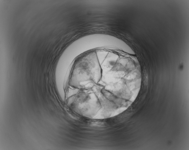 X0000116140471201001041036