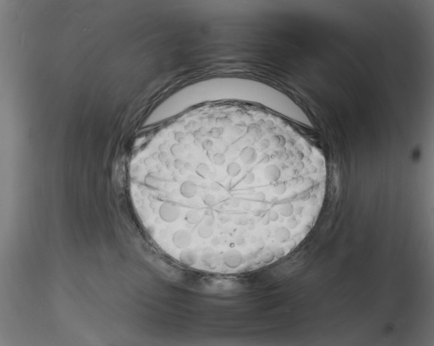 X0000116140475201001041036