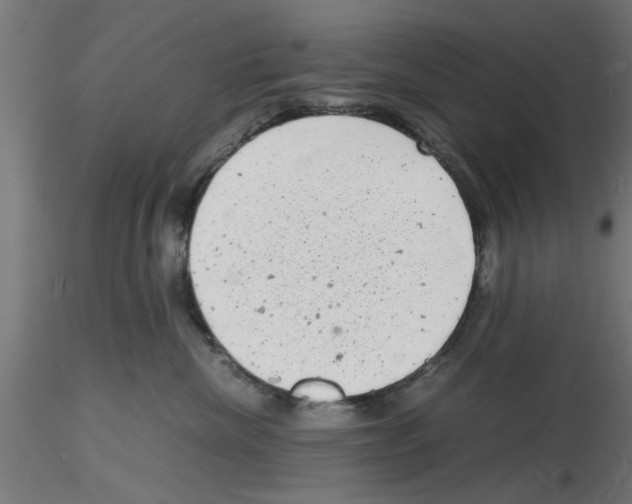 X0000116140476201001041036