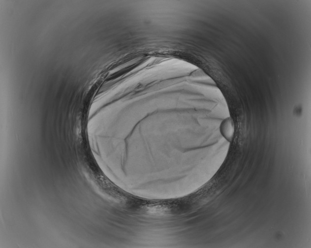 X0000116140500201001041035