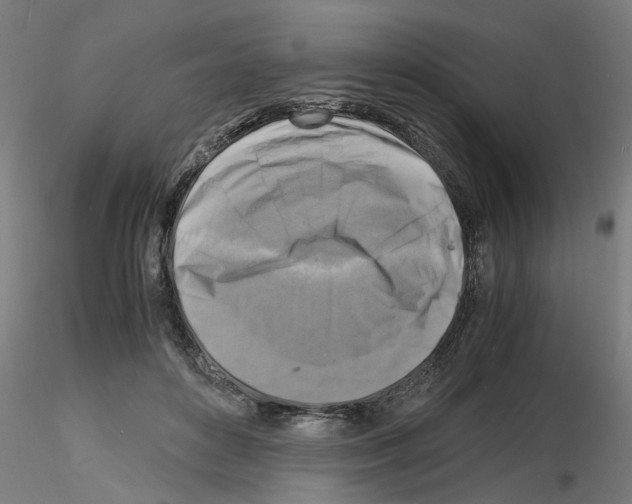 X0000116140504201001041035