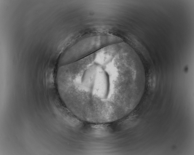 X0000116140516201001041035