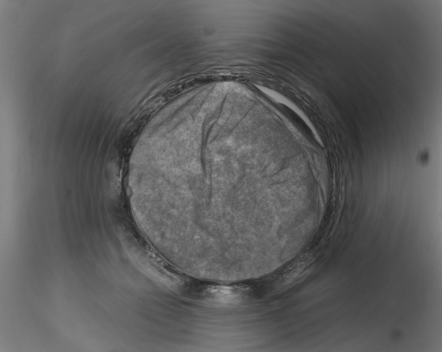 X0000116140558201001041035