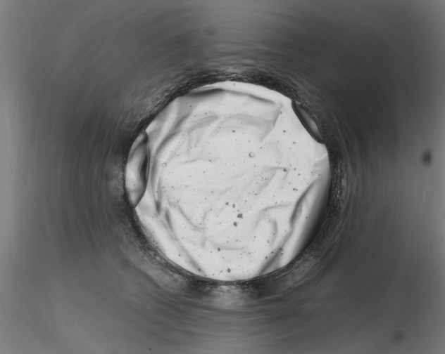 X0000116140562201001041035