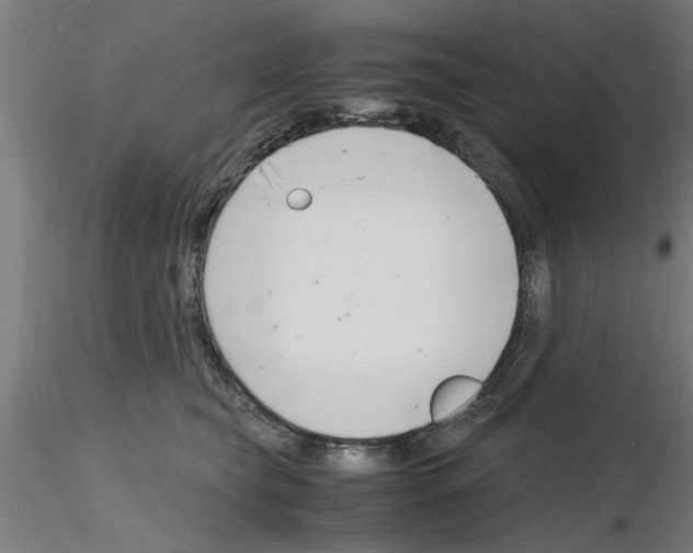 X0000116140565201001041035