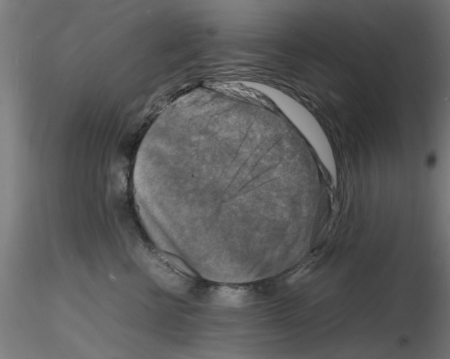 X0000116140570201001041035